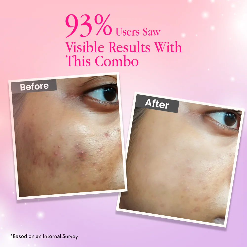 Brightening & Anti-Pigmentation Combo - Image 4