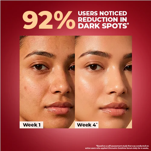 Korean Dark Spot Correction Outshine Serum - Image 3